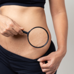 Área Privada del Instituto Nacional de Micropigmentación. Curso Profesional en Micropigmentación de Cicatrices, Estrías e Inkless 